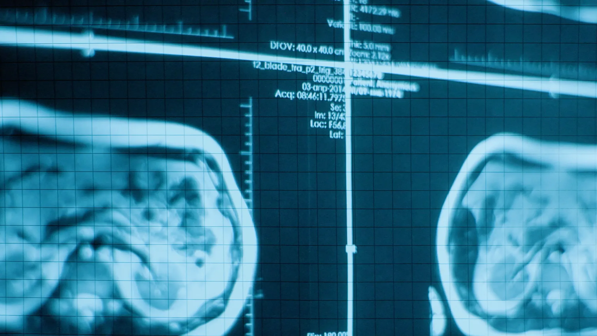 Epsilon Health — Radiology rebuilt from the ground up