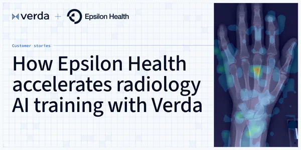 How Epsilon Health accelerates radiology AI training with Verda